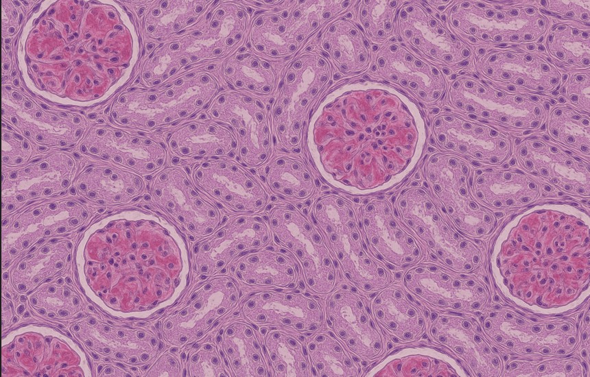 Familial Renal Amyloidosis in a Shar Pei Dog